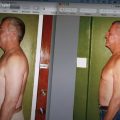 forks over knives joey aucoin before and after photo